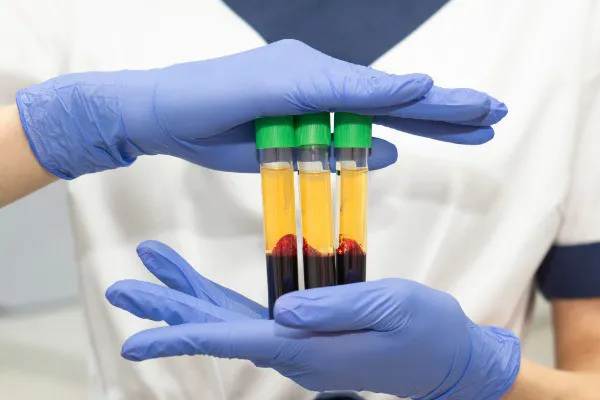 A Milestone For PRP Safety A Milestone For PRP Safety