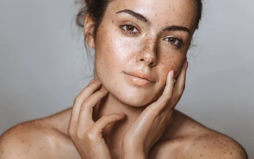 Morpheus8 For Sun Damage Image