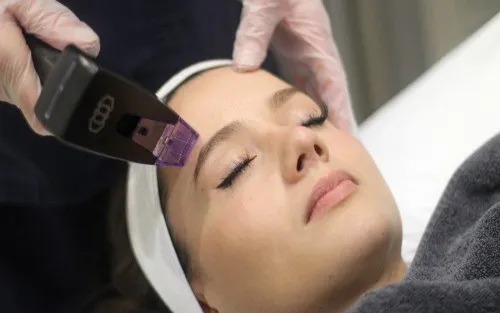 What Are The Benefits Morpheus8 Treatment? Image