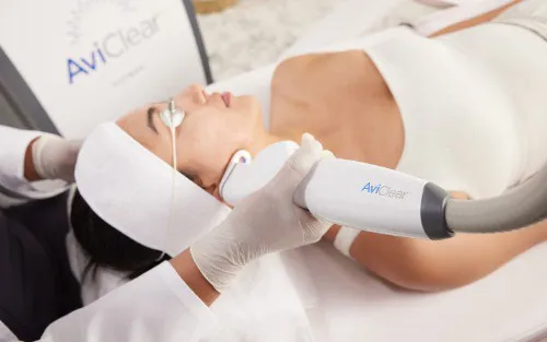 AviClear