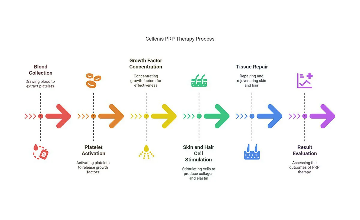 PRP Process