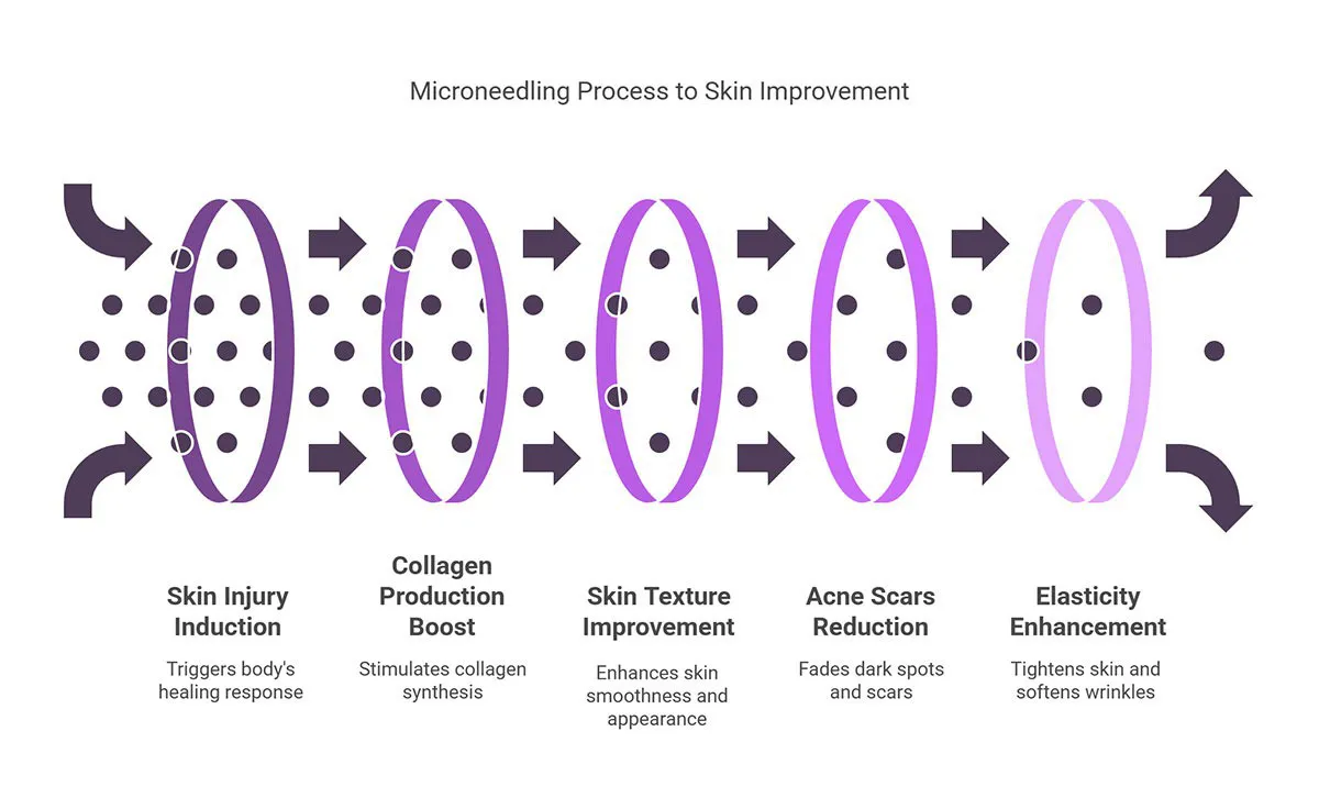 Microneedling Process To Skin Improvement