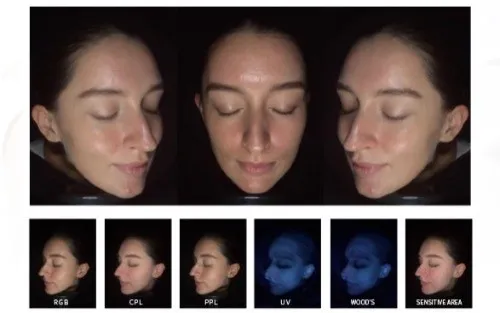 Can The MC10 Analyse? Image