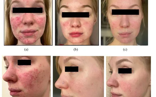 Before And After Results Image