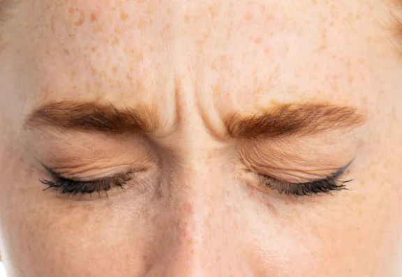 What are other treatment options available for treating lines and wrinkles?