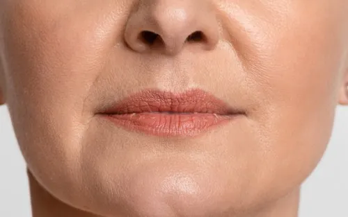 Botox for Lip Lines