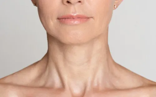 Botox for Neck Bands