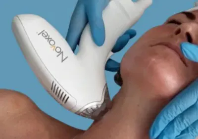 How Thermal Ablation & Tixel For Skin Rejuvenation Work Image