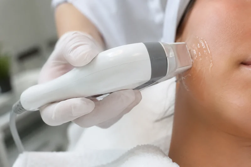 Facial ultrasound scanning probe being used during an aesthetic consultation