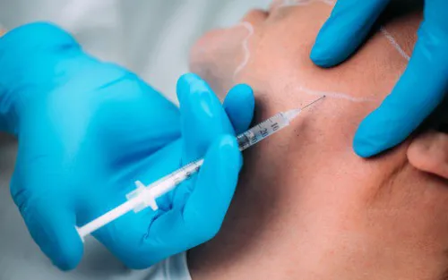 Dermal Filler For Jawline and Chin