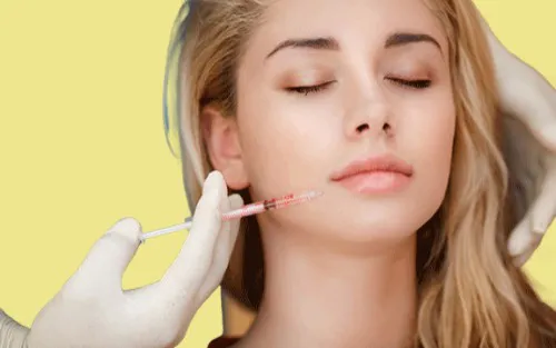 Dermal Filler For Nasolabial Fold