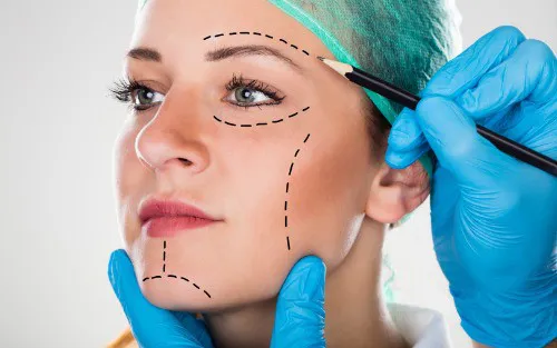 Where Can Dermal Fillers Be Used?