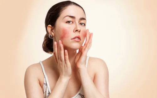 Hydrafacial for Rosacea