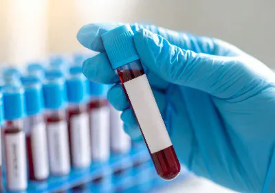 Potential Risks And Side Effects Of PRP