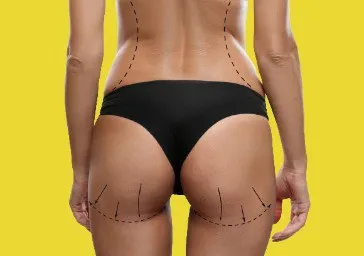 Body Implants (Pectoral, Calf, Buttock) clinics