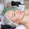 Ultrasonic Skin Tightening