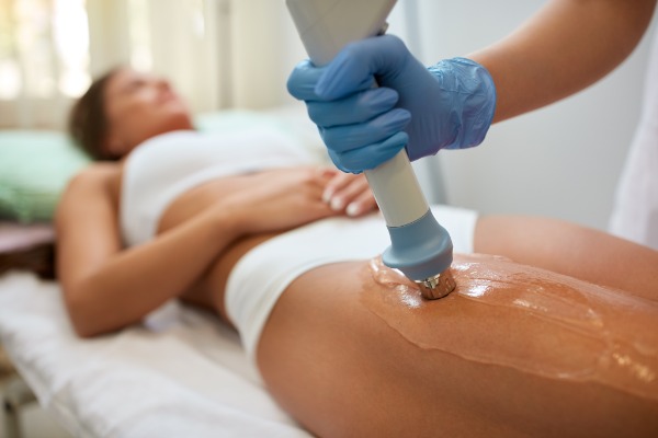 Acoustic Wave Therapy For Cellulite (e.g. Lipotripsy) Image