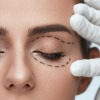 Blepharoplasty (Eyelid Surgery)