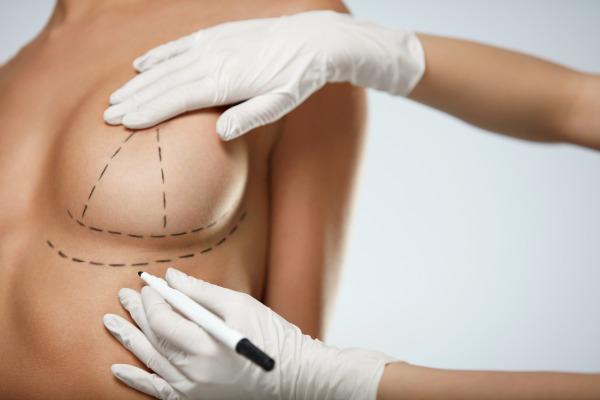Breast Lift or Mastopexy information Image