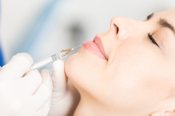 Dermal Fillers, Lip Fillers - Hyaluronic Acid Injections Information Image