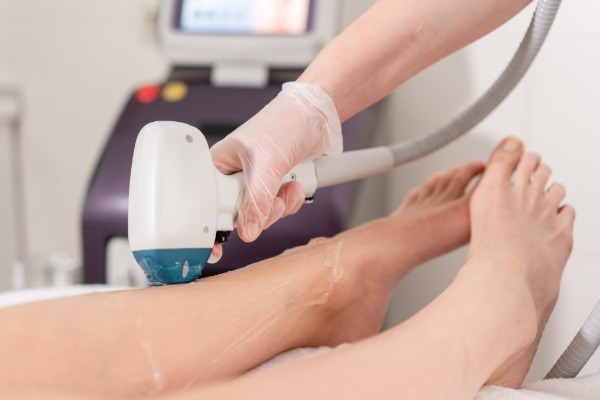 Laser & IPL Hair Removal, Permanent Hair Reduction Information Image