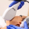 Laser and IPL Skin Rejuvenation 