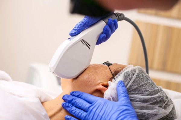 Laser and Intense Pulsed Light (IPL) Skin Rejuvenation Information  Image