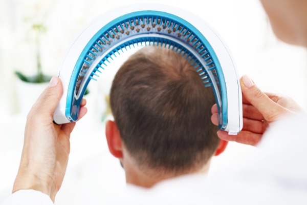 Laser Hair Loss Therapy Information Image