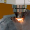 LASIK Laser Eye Surgery