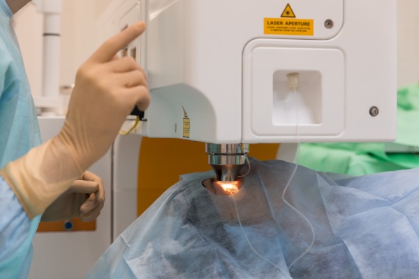 LASIK (Laser-Assisted in Situ Keratomileusis) Laser Eye Surgery Image