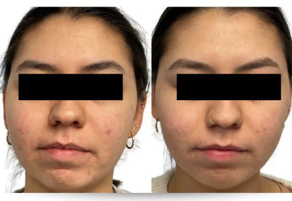 before and after 3