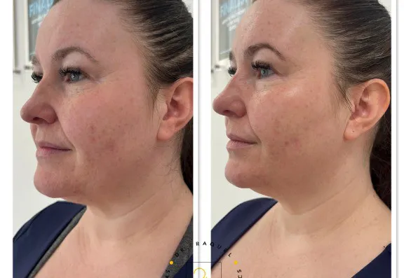 Before and after images