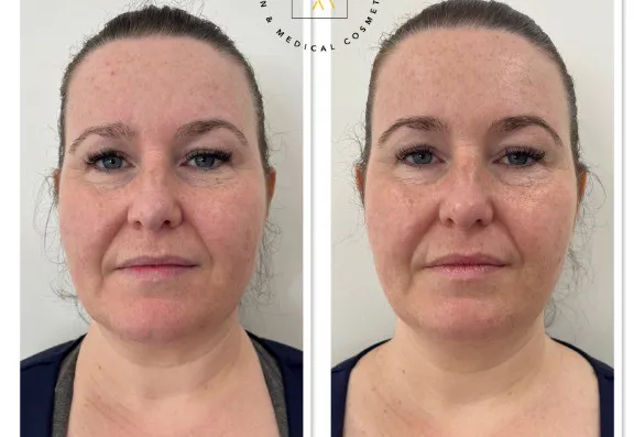 Before and after images