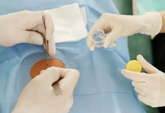 Mole removal method