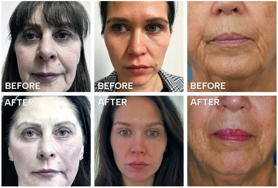 before and afters