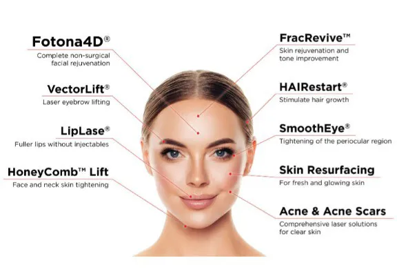 Fotona® Lasers  (SP Dynamis, etc.) Fotona® Lasers  (SP Dynamis, etc.)