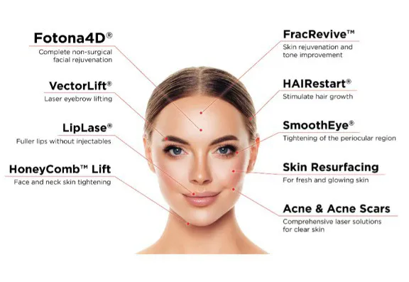 Fotona® Lasers (SP Dynamis, etc.) Fotona® Lasers (SP Dynamis, etc.)