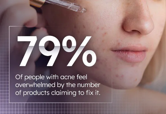 Acne advice Acne advice