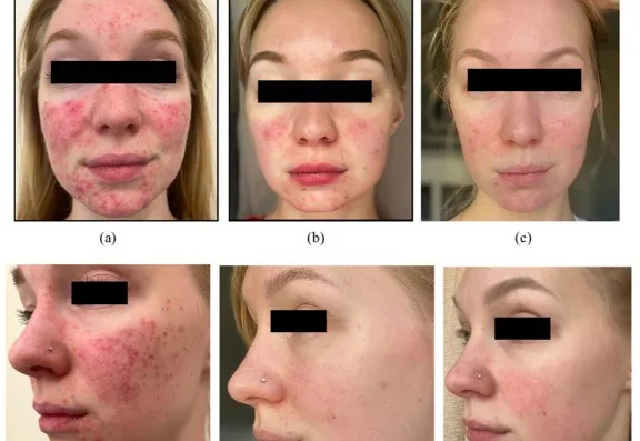 As more clinics invest in advanced technologies As more clinics invest in advanced technologies