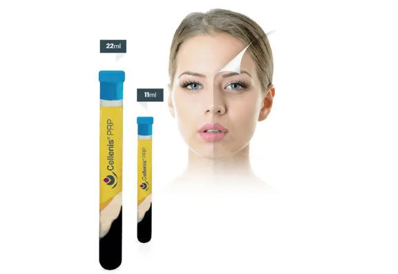 Why Cellenis PRP Is Worth Highlighting in Your Clinic Profile Why Cellenis PRP Is Worth Highlighting in Your Clinic Profile