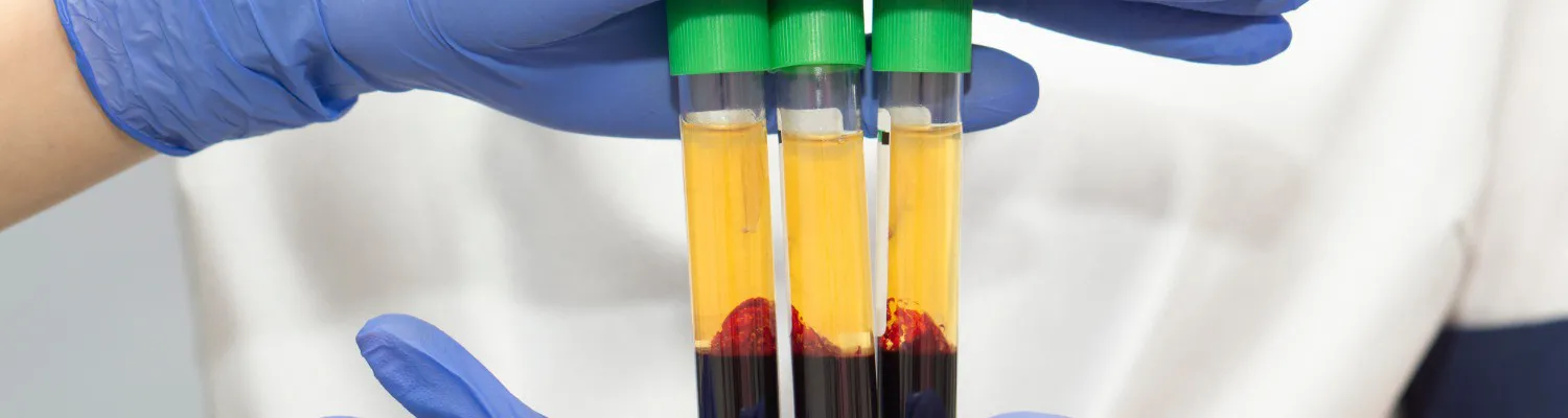 A Milestone For PRP Safety