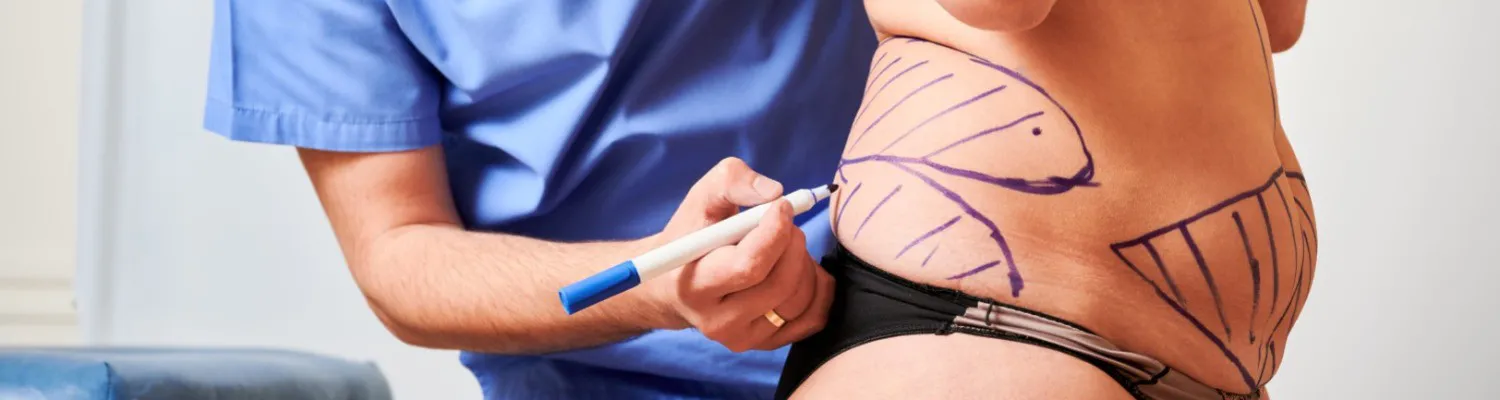 ASPS Reveals 2022's Most Sought-After Procedures