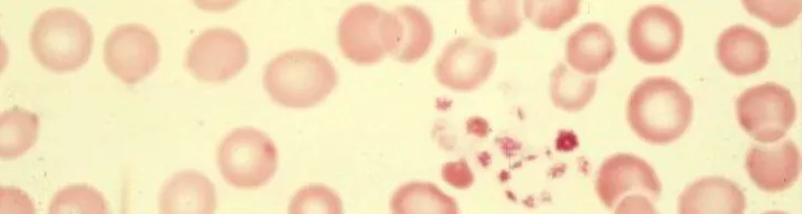 Billions of Platelets Concentrated in Cellenis® PRP