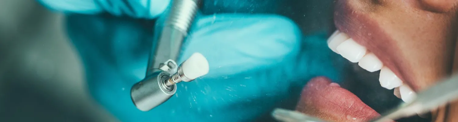 Illegal Tooth Whitening Crackdown by Government and Dentists
