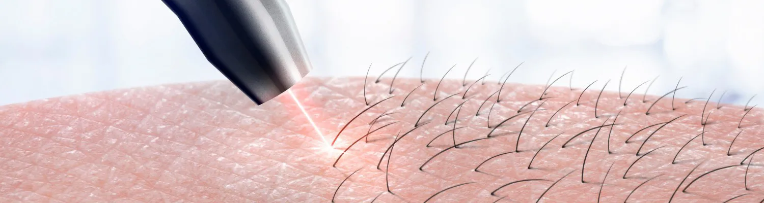 Laser/IPL Suppliers Use De-regulation Over Patient Safety