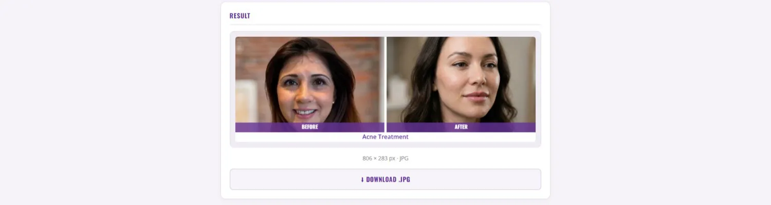 New Member Tool: Before and After Collage Builder, Create Professional Comparison Images in Minutes