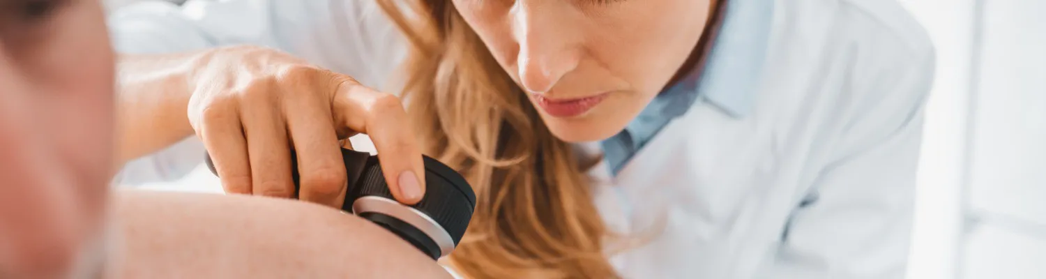 Non-melanoma Skin Cancer Deaths Will Overtake Melanoma Deaths
