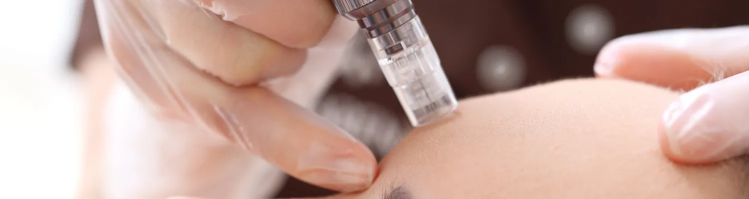 Nouveau Visage™ Launches New 5-in-1 Regenerative Microneedling System in the UK