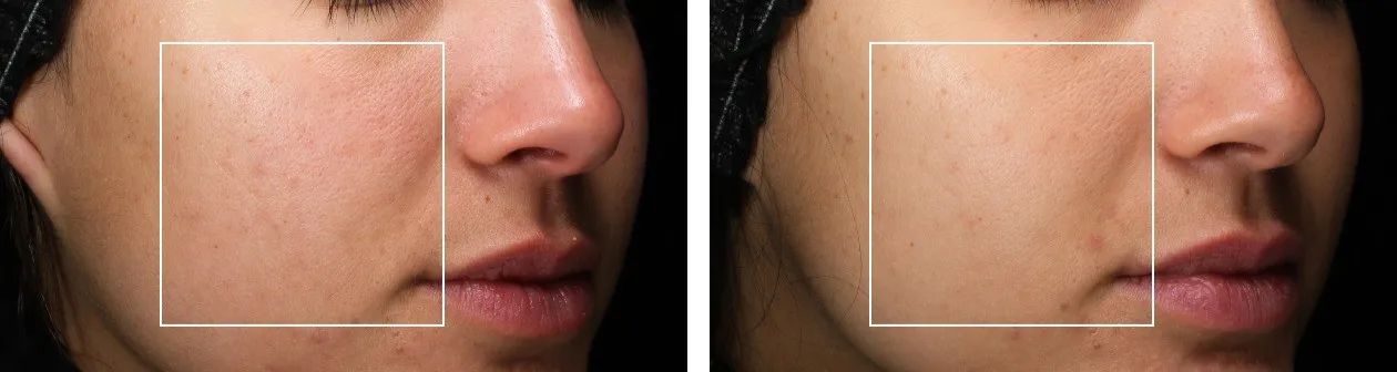 OBAGI Medical Launches Overnight Skin Renewal Cream