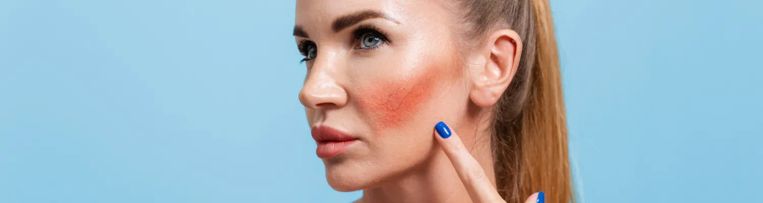 Skin Discolouration